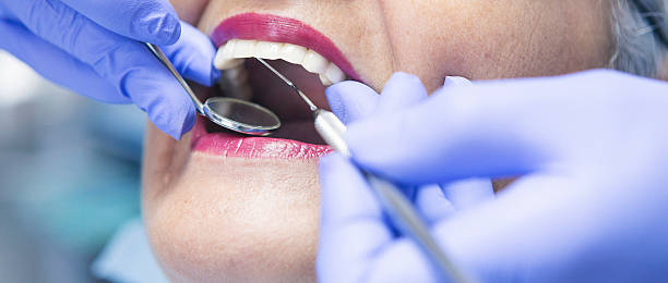 Best Emergency Tooth Extraction in Ofallon, IL